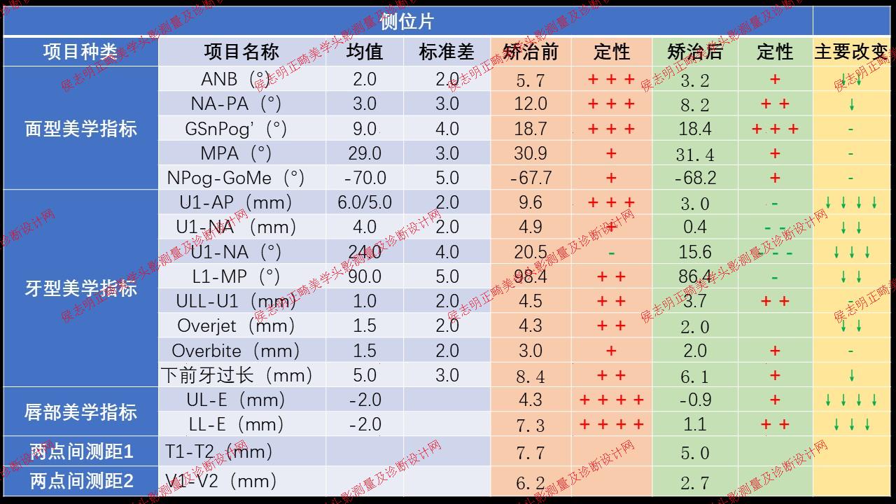 曲伟病例报告-MJ-修改 P3.jpg